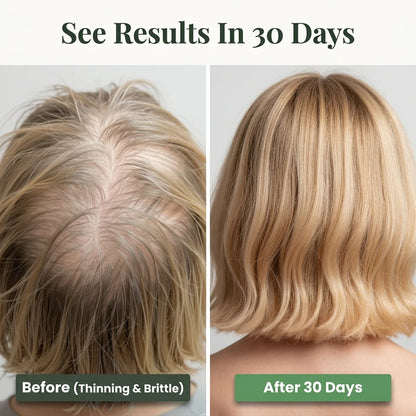 Natural Hair Growth Oil — Nourishes The Scalp For Fuller-Looking Hair