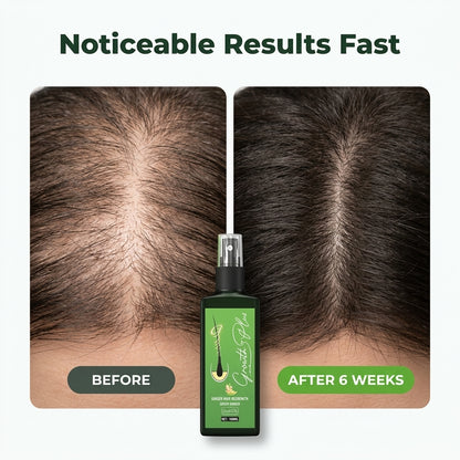 Nourishing Ginger Hair Spray — Fuller-Looking Hair With Daily Scalp Care