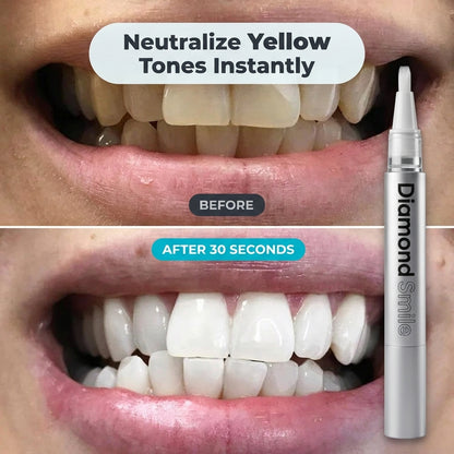 Instant Teeth Whitening Pen