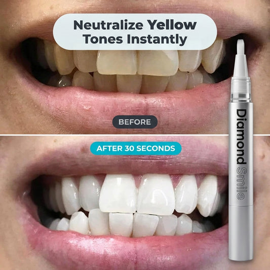 Instant Teeth Whitening Pen