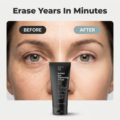 Instant Eye Cream — Visibly Smooths Dark Circles, Puffiness & Fine Lines