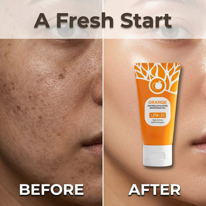 Citrus Enzyme Exfoliating Gel — Smoother, Brighter-Looking Skin Without Harsh Scrubs