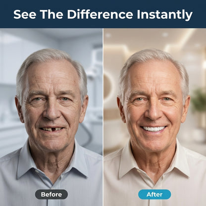 Snap-On Veneers - Instantly Improve Your Smile